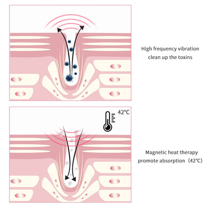 USB Ultrasonic eye and lip massage pen